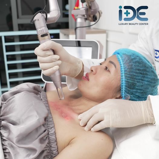 Thẩm mỹ viện quốc tế IDE