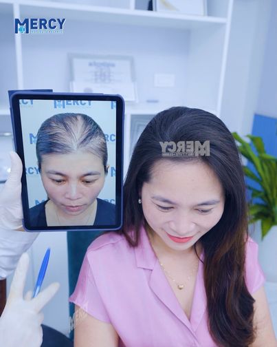 Viện Da Liễu Mercy - Điều Trị Rụng Tóc Công Nghệ Cao