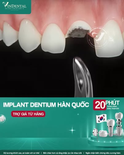 Nha Khoa Quốc Tế VinDental Luxury - Bảo Lộc, Lâm Đồng