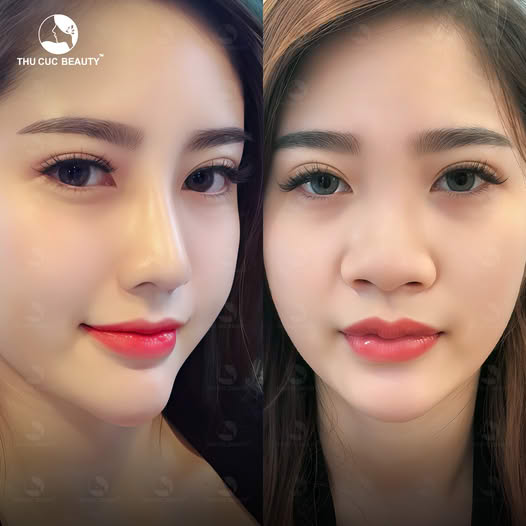 Bệnh Viện Thẩm Mỹ Thu Cúc TP HCM
