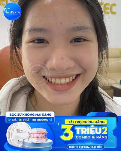 Ts Bác sĩ Quang Huynh - Trưởng Phòng Khám Nha Khoa Hồ CHí Minh