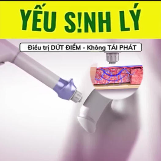 Bác Sĩ Chuyên Điều Trị Nhanh Ra HCM