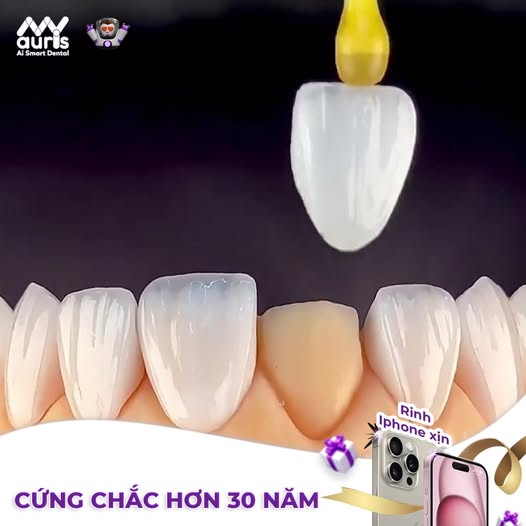 Răng Sứ My Auris - May Đo Nụ Cười Bền Đẹp