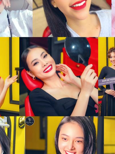 NT KING Dental Clinic - Dán Sứ Veneer Không Mài Răng