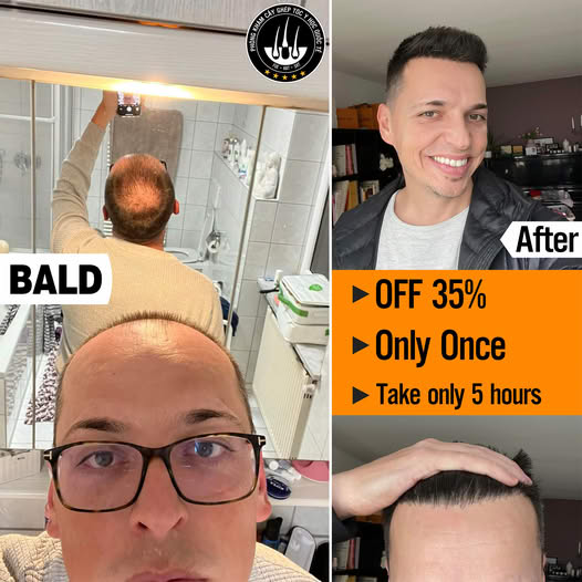 Hcm Hair Transplant Institute