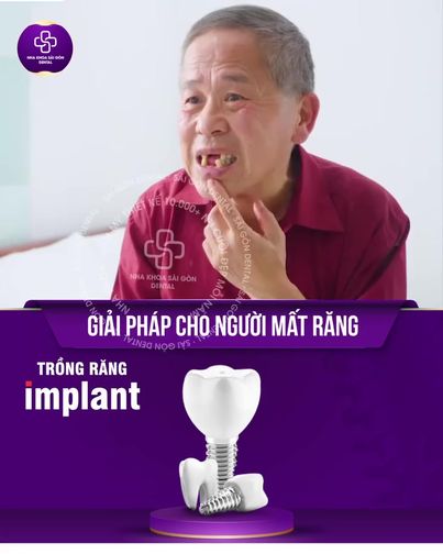 Ths. Bác Sĩ Quốc Thịnh - Trưởng Khoa RHM Đại Học Y TP.HCM