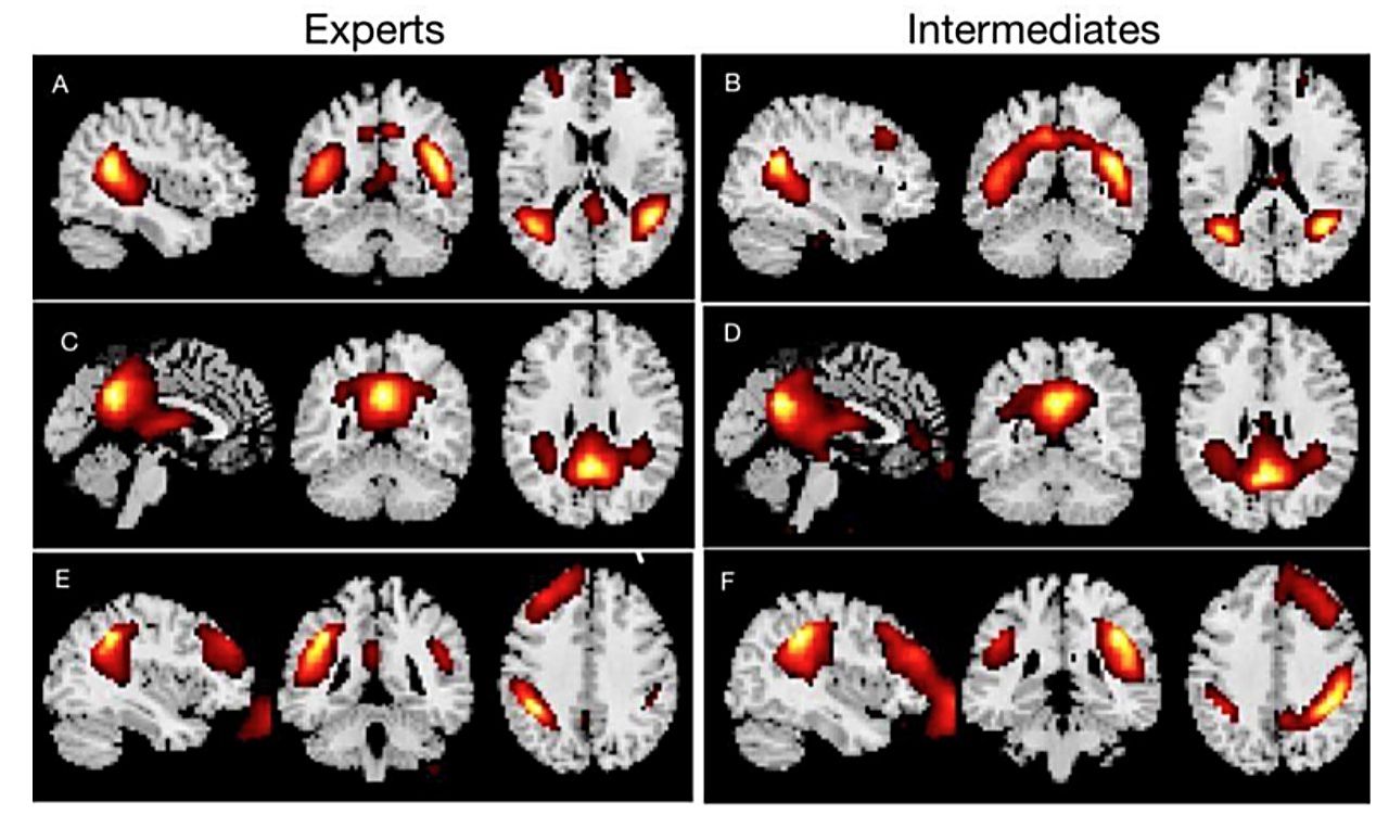 LLMへの指示が得意な人は脳の働きが違う──「プロンプト力」がfMRI研究で初めて科学的に確認されるのサムネイル画像
