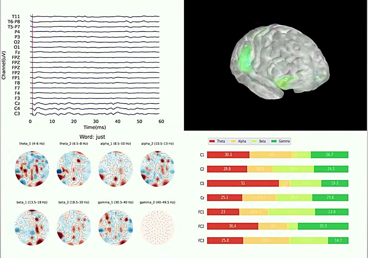 心を読むAI「DeWave」脳波を読み文字に起こすフレームワークを発表　シドニー工科大学のサムネイル画像