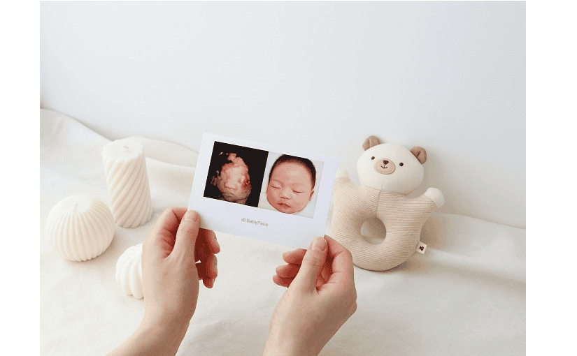 超音波写真で赤ちゃんの顔を予測する「BabyFace」が日本市場に進出のサムネイル画像