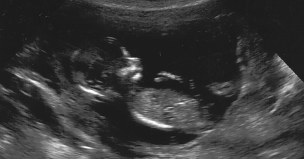 Vitaliteitsecho – Verloskundigen Lelystad