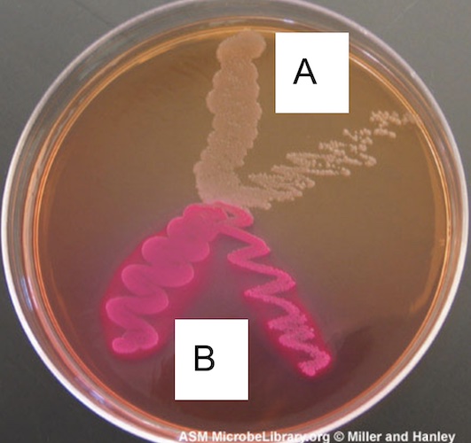  An labeled photograph of MacConkey Agar. The letter A labels a brown species that is the same color as the medium. The letter B labels a bright prink species.