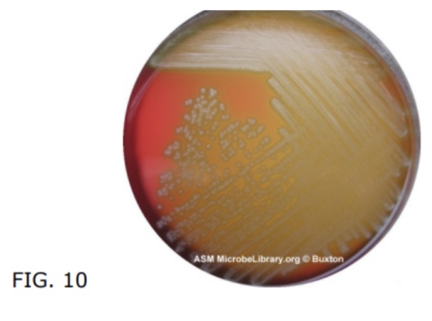  AAn agar showing  greenish or brownish discoloration of the surrounding agar medium.