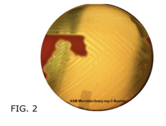  An agar showing complete lysis of red blood cells.