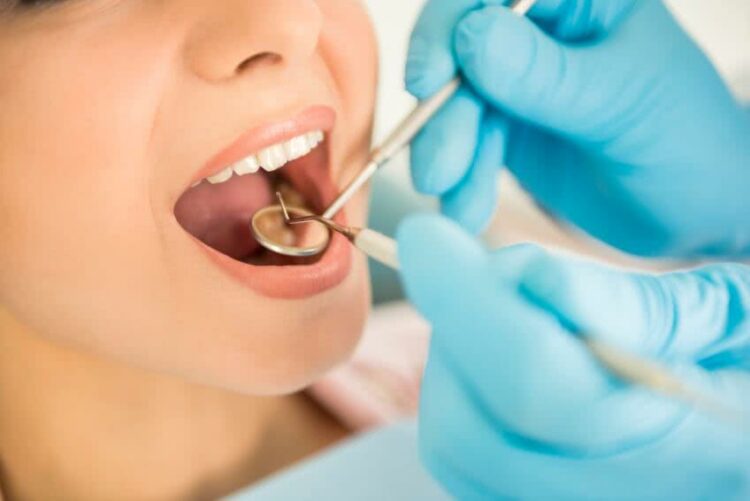 Curetage dentaire : fonctionnement et remboursement