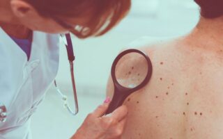 Dermatologue : remboursement et tarifs des consultations