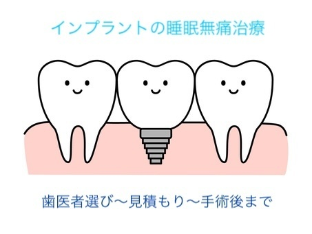 【体験談】睡眠無痛治療(静脈鎮静法)でインプラント🦷歯医者選び〜見積もり〜手術後まで🦷
