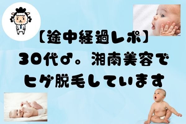【途中経過レポ】30代男。湘南美容で絶賛ヒゲ脱毛中！