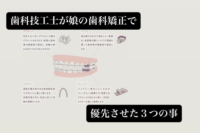 歯科技工士の私が娘の歯科矯正の時に先生に求めた３つの事です。
