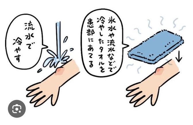 蚊に刺されたときはどうしていますか？