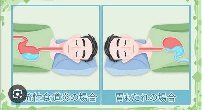 夜寝る時に胃がムカムカして寝られない時