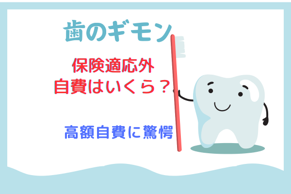 歯科のギモン？保険適応外はいくら？