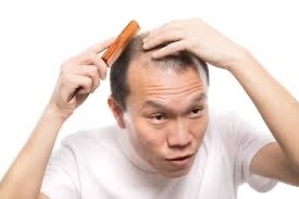 現役美容師が教える薄毛になる最悪行動4選