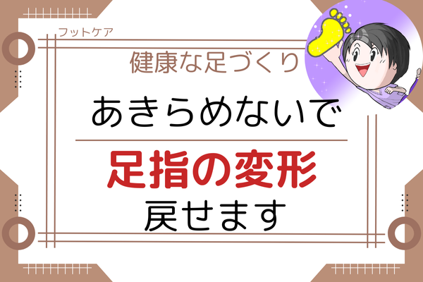 【フットケア】足指の変形をもどす方法