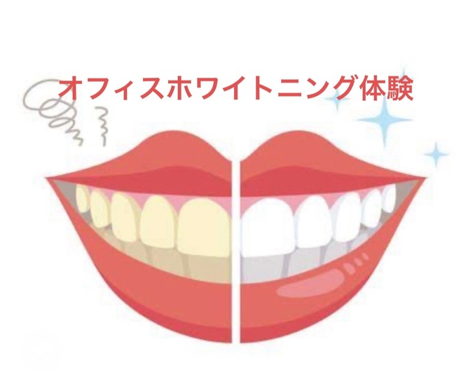 【歯科】①歯科医院で行うオフィスホワイトニング体験レポート