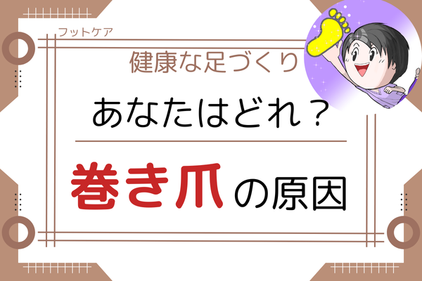 【フットケア】巻き爪の原因　詳しく解説