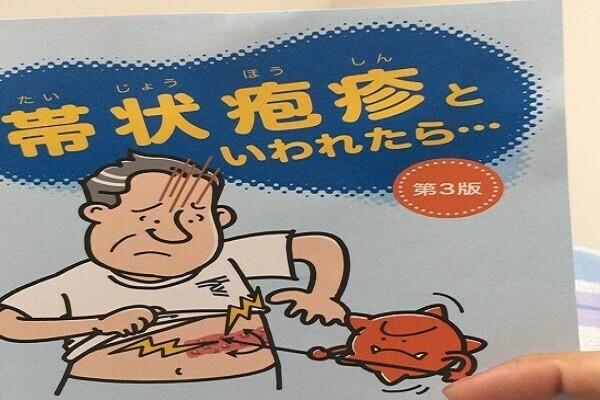 【体験談】帯状疱疹後神経痛にかかったら