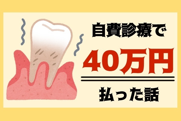 【体験談】歯の自費診療で40万円払った話