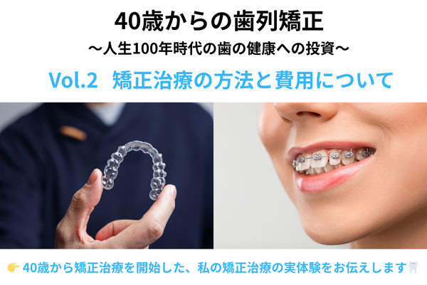 【Vol.2 矯正治療の方法と費用】40歳からの歯列矯正 〜人生100年時代の歯の健康への投資〜