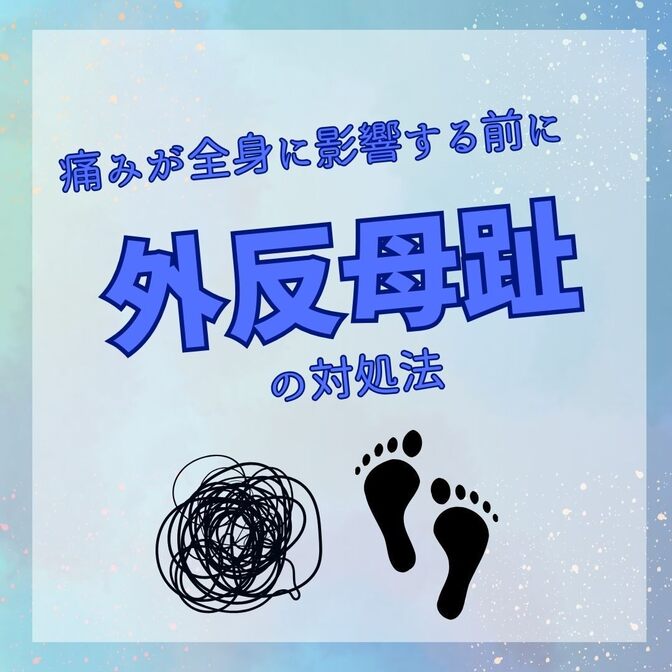 「外反母趾」の痛みと変形の対処法