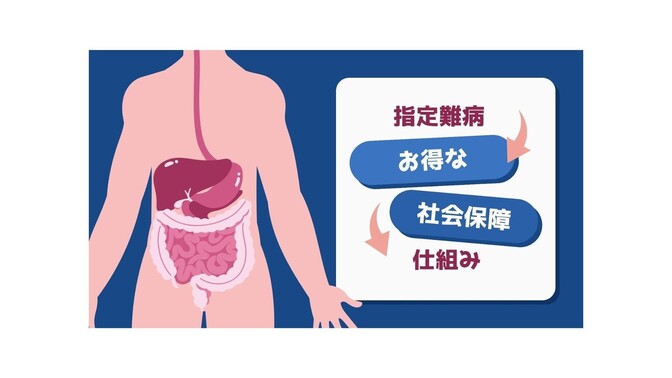 クローン病になって気づいた社会保障の話：特定医療費について