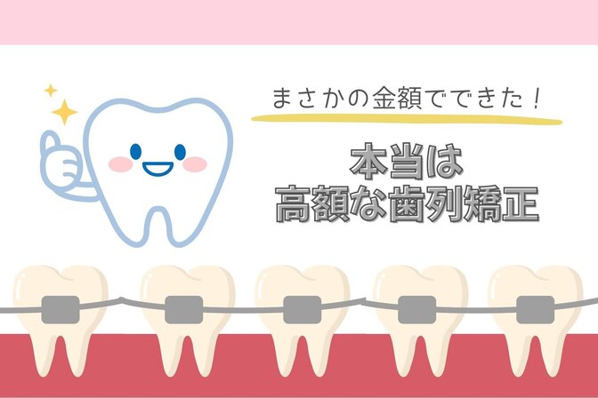 【こんな金額💰でできるの？】私が体験した歯列矯正①