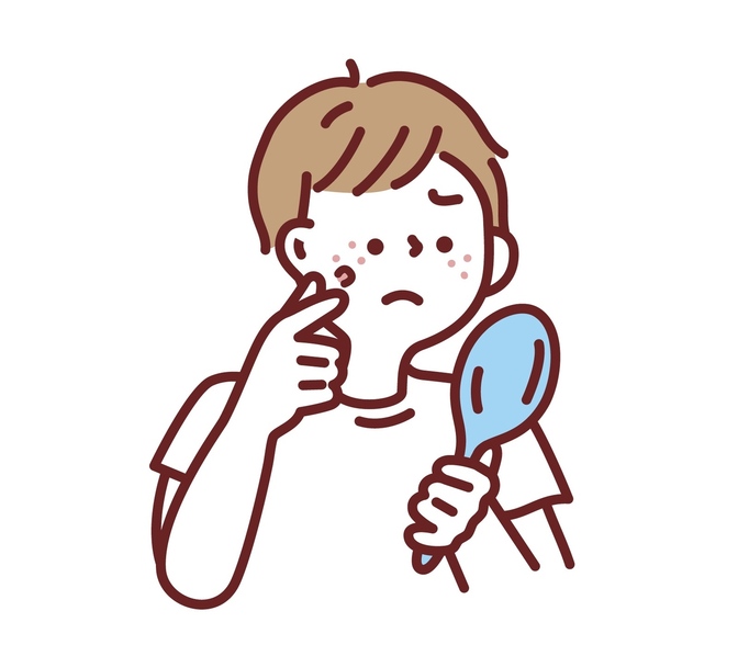 ニキビと生きる