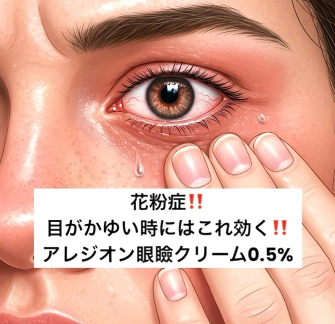 花粉症でつらい目のかゆみにはコレ！！