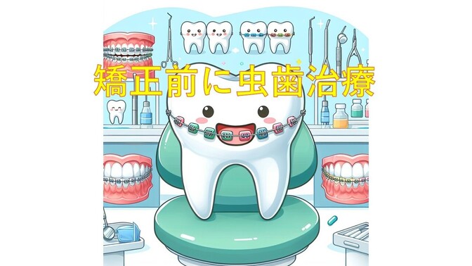 【実録】大人の矯正歯科⑦ ～矯正器具をつける前に、まず虫歯治療～