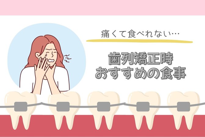 歯列矯正時のご飯どうしてる？👀【私が体験した歯列矯正②】