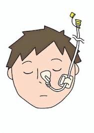 口から食事が摂れなくなった場合にできること