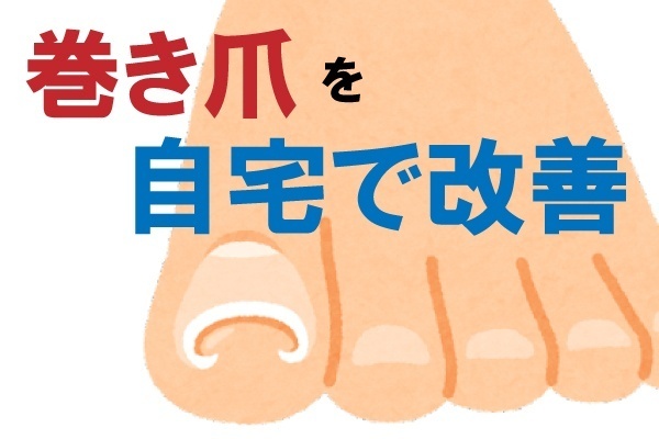 ２０年困っていた巻き爪が、たったの１日で改善！