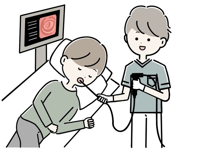 内視鏡専門医による「楽に胃カメラを受ける方法」