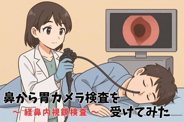 【体験談】経鼻内視鏡検査を受けてみました