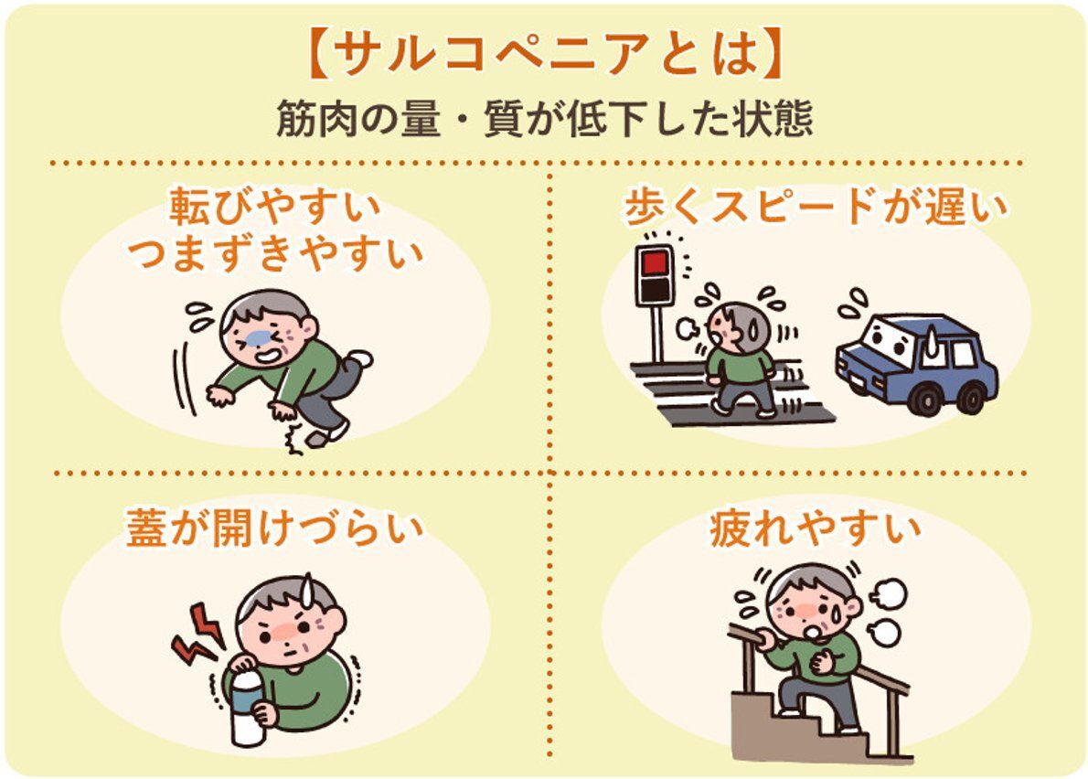 サルコペニア.jpg