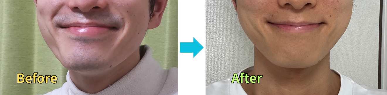 名称未設定のデザイン (4).png