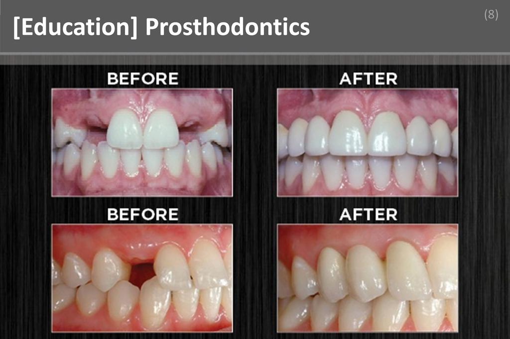 ### Prosthodotics Image