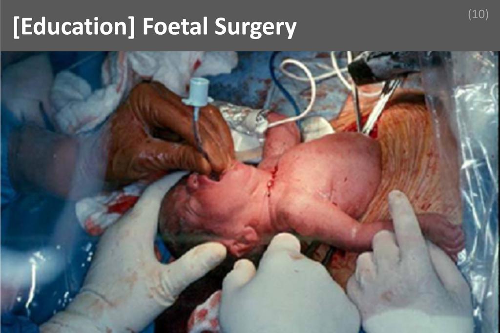 ### Foetal Surgery Image