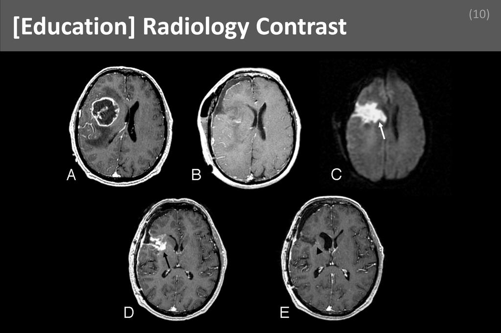 ### Radiology Contrast Image