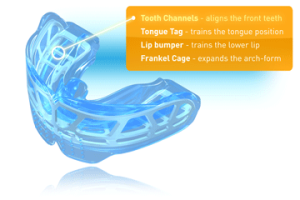 Orthodontic treatment