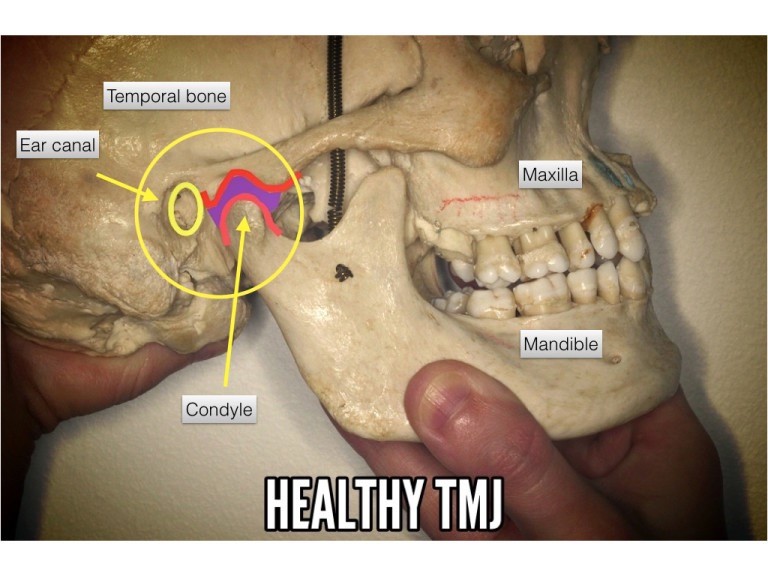 Healthy TMJ